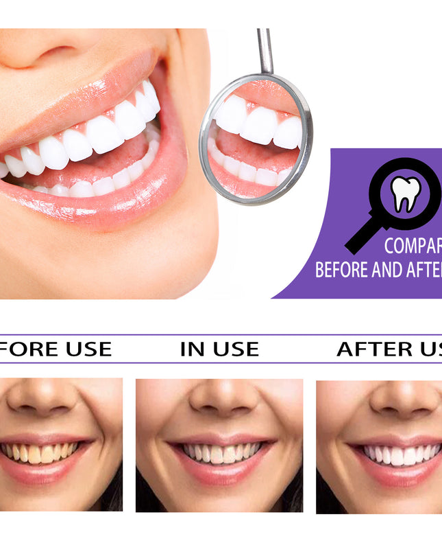 Teeth Whitening Toothpaste Whitening Teeth Removal