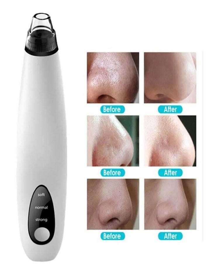 Electric Blackhead Remover – Diamond Tip Pore Vacuum Cleaner