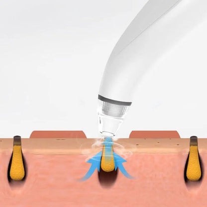 Electric Blackhead Remover – Diamond Tip Pore Vacuum Cleaner