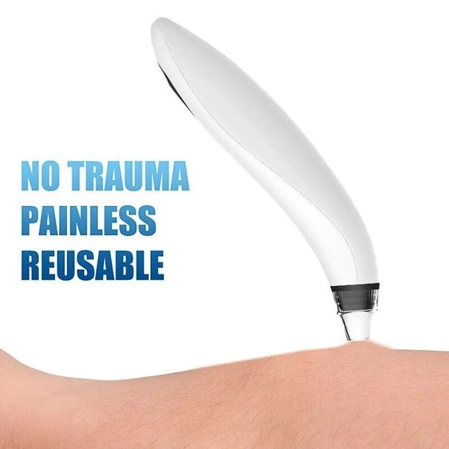 Electric Blackhead Remover Cleaner Face Diamond Pore Vacuum Suction White Heads