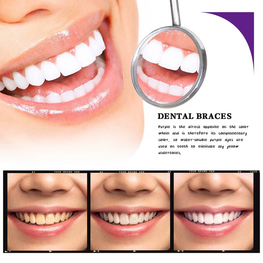 V34 Teeth Whitening Toothpaste 30ml